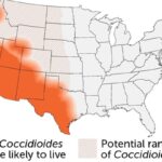 California droughts may help valley fever spread