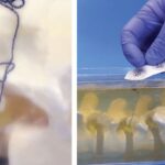 A next-gen pain drug shows promise, but chronic sufferers need more options